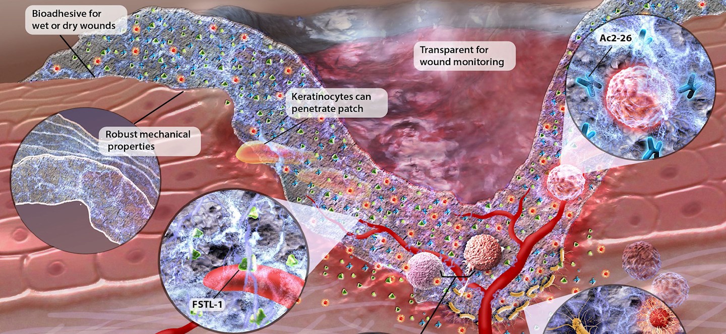 A New Way To Treat Chronic Wounds | Office Of Research And Innovation