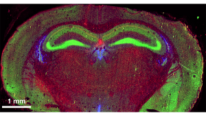 Quantitative elemental map of a mouse brain