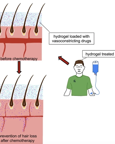 Diagram of gel's effect on cancer hair cells