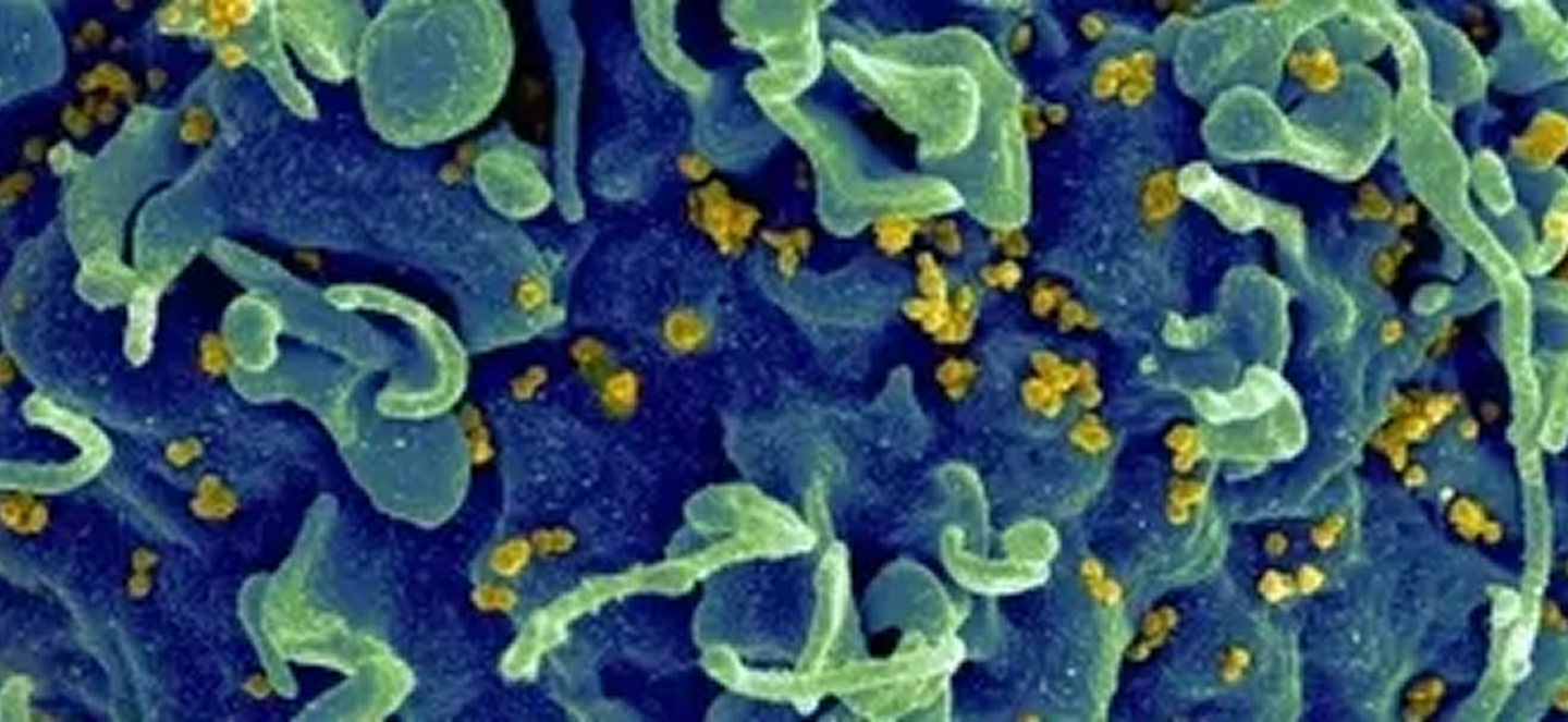 Microscopic image showing virus particles