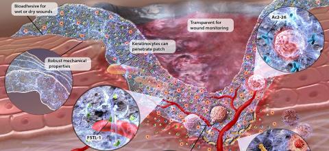 Image showing new biopolymer dressing 