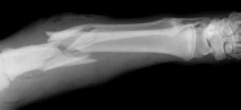 An e-ray image of a broken animal bone. 