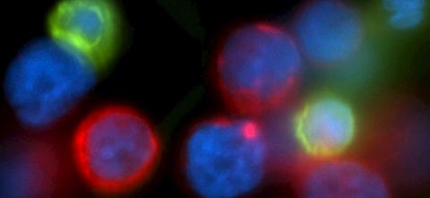 Decorative image representing tumor cells