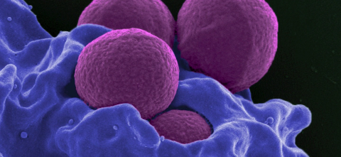 A microscopic image of staph