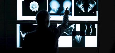 Joe Hefner pointing at a wall display of human bone x-rays