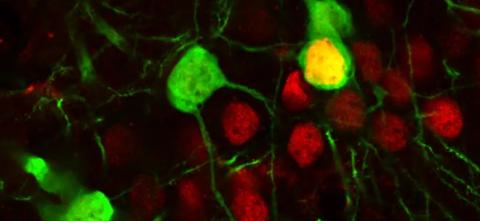 Hippocampus Neurons