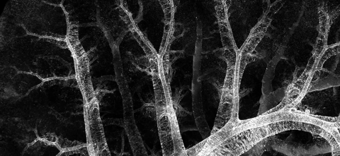 Microscopic image showing muscle surrounding airway and blood vessel structures near the outer surface of a fetal lung.