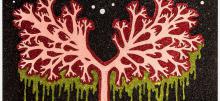 Image of art, it includes a pink tree with a black background. The art is sparkly. 