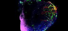 A scan of a tiny human heart