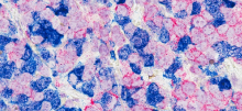 Cells under a microscope 