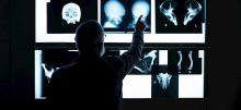 Joe Hefner pointing at a wall display of human bone x-rays