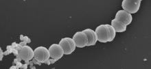 Micrograph of Group B Streptococcus