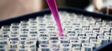 Multiple test tubes 